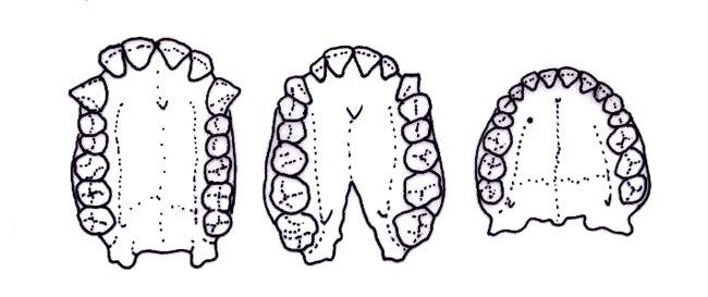Human Jaws Evolution - Source: Australian Museum